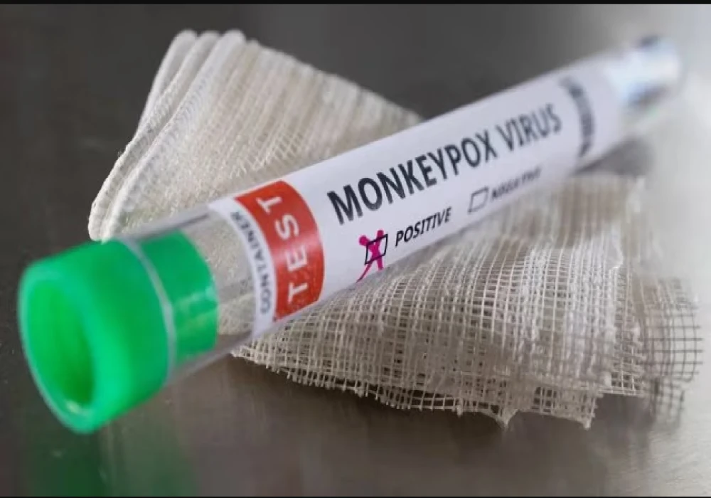 What is MonkeyPox Virus | Global Health Emergency | Symptoms | Prevention What is MonkeyPox Virus | Global Health Emergency | Symptoms | Prevention
